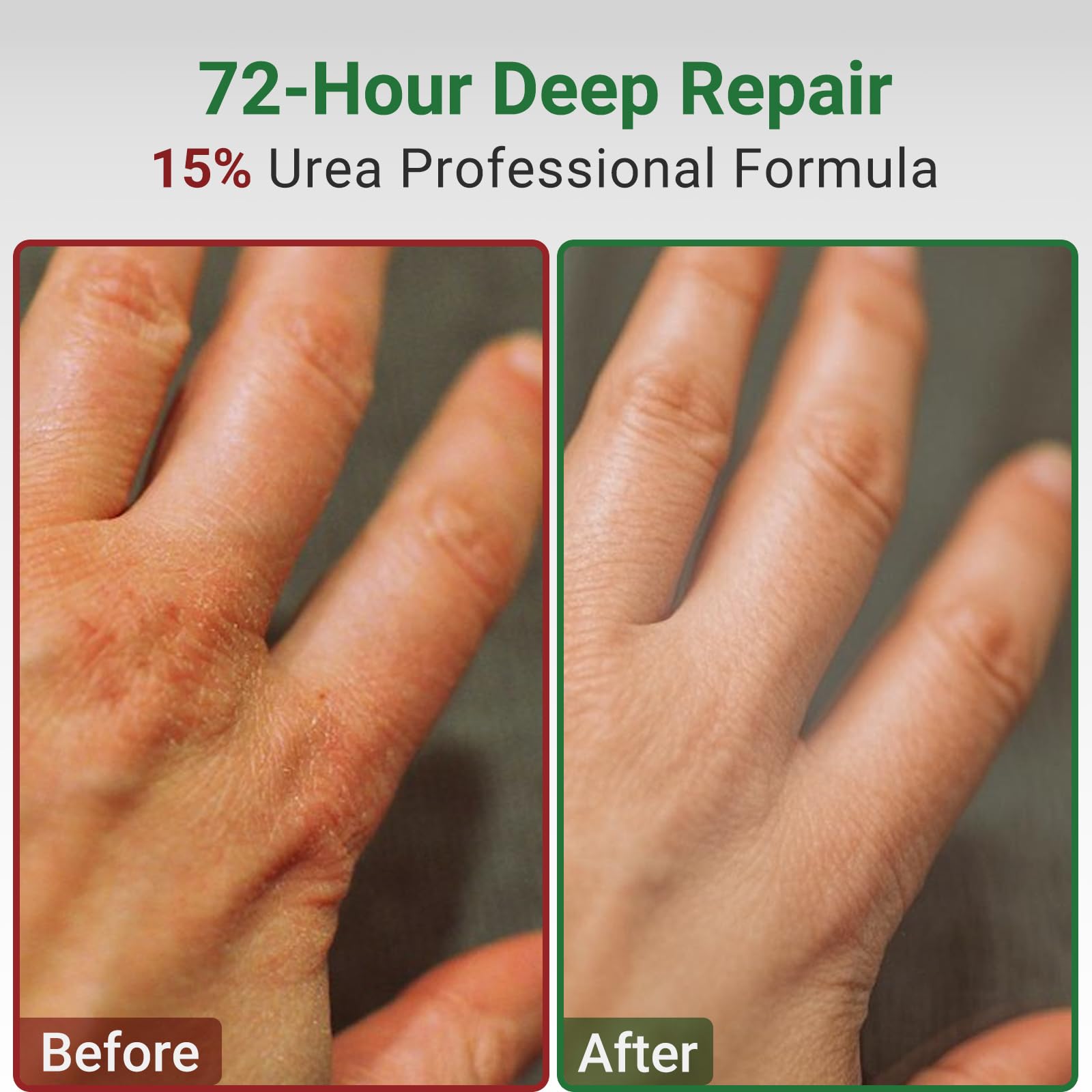 ishancare crema idratante & crema riparativa con urea – Trattamento intensivo per pelle secca e screpolata – lenisce mani e talloni ruvidi – 200 vetro