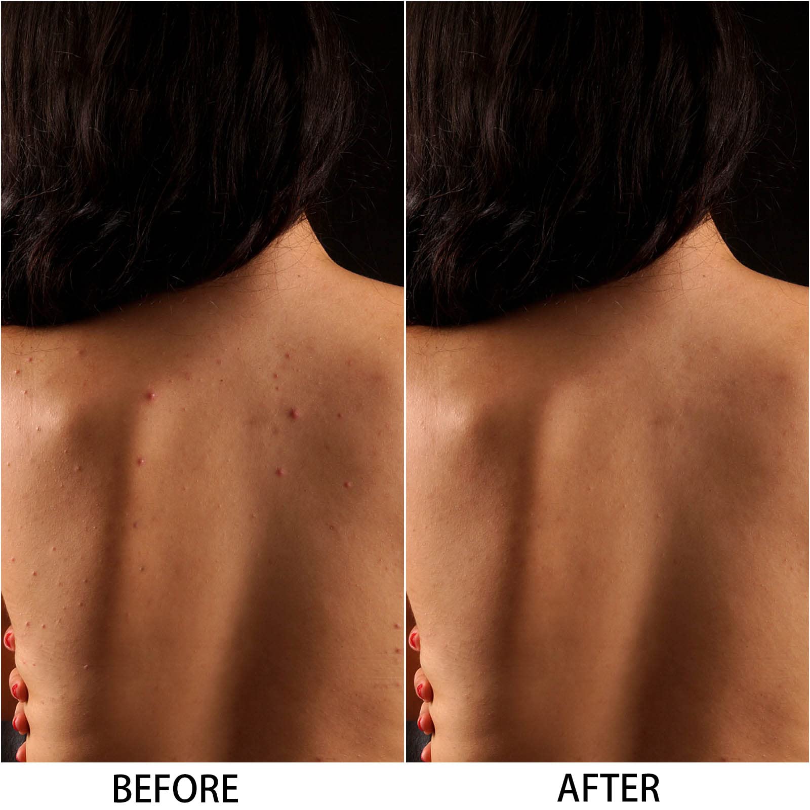 6 Pcs African Bath Sponge Long Exfoliating Net Nylon Body Back Scrubber (7.87x25.6inch)