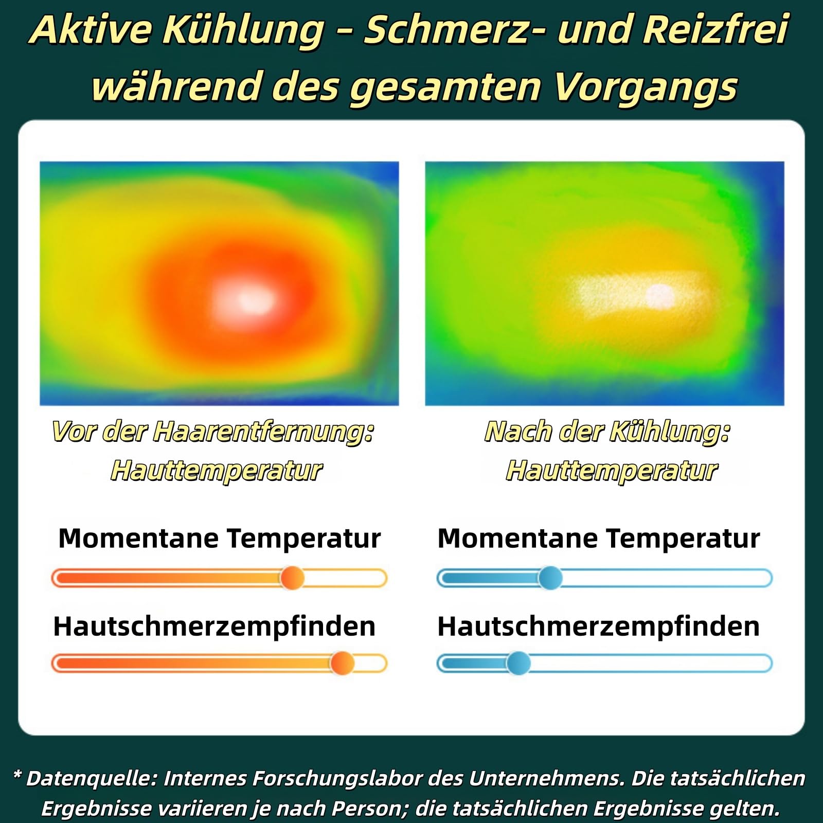 IPL Geräte Haarentfernung Laser mit Gefrierfunktion, Schmerzfreie Haarentfernungsgerät,Geräte Haarentfernung mit Saphir-Eis, Lichtimpulse und Energiestufen für Körper, Gesicht, Bikini (Dunkelgrün)