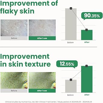 AXIS-Y PHA Resurfacing Glow Peel Yüz Peelingi 50 ml