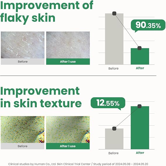AXIS-Y PHA Resurfacing Glow Peel Yüz Peelingi 50 ml