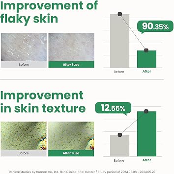 AXIS-Y Pha Resurfacing Glow Peel 10% Pha Fruit Extract Mild Peeling Gel Exfoliator Pore Minimizer For Face Vegan Korean Skin Care Glass Skin Face Peel 1.69 Fl. Oz.