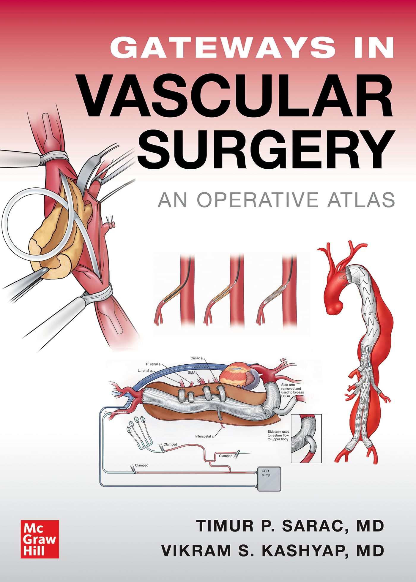Gateways in Vascular Surgery: An Operative Atlas: 9781260474299