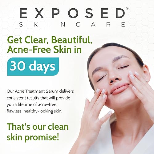 Miniatura 9 de Exposed Skin Care, Suero de tratamiento para el acné con peróxido de benzoilo al 3.5% - Tratamiento ligero para manchas de acné - Elimina