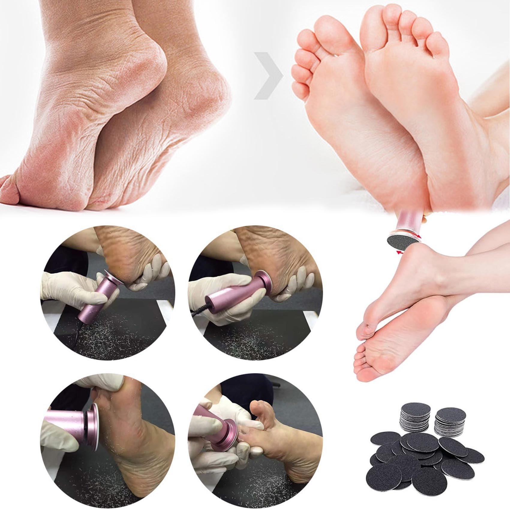 Avalaine Callus Remover, Avalaine Callus Shaver,Elettrico Per Piedi con 60 Cuscinetti,Velocità Regolabile,Lima Elettrica Per Piedi Per Pelle Dura,Pelle Secca e Morta,Talloni Screpolati,Calli (Nero)