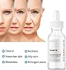 Niacinamide 10% + Zinc 1% Serum for Women, 30 ml / 1 Fl Oz Refreshing Niacinamide Serum for Face, Niacinamide Face Serum for Acne