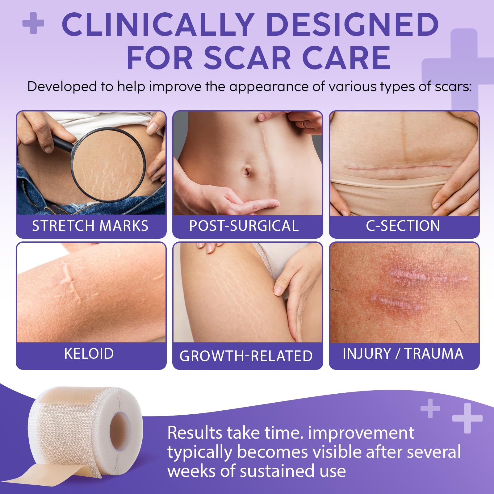 Silicone Scar Sheets,Cinta de cicatrices de silicona 1.6 '' x 60 '',Hoja de cicatrices de silicona profesional reutilizable para cicatrices quirúrgicas,Tuck abdominal, keloide, acné,Sección C