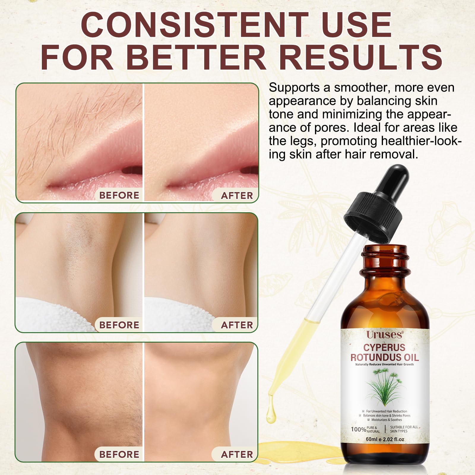 Huile Cyperus Rotundus, Huile Inhibitrice de Pilosité au Cyperus Rotundus 60ml | Réduit la Repousse, Répare la Peau & Resserre les Pores | 100% Naturelle, Vegan & Adaptée aux Peaux Sensibles