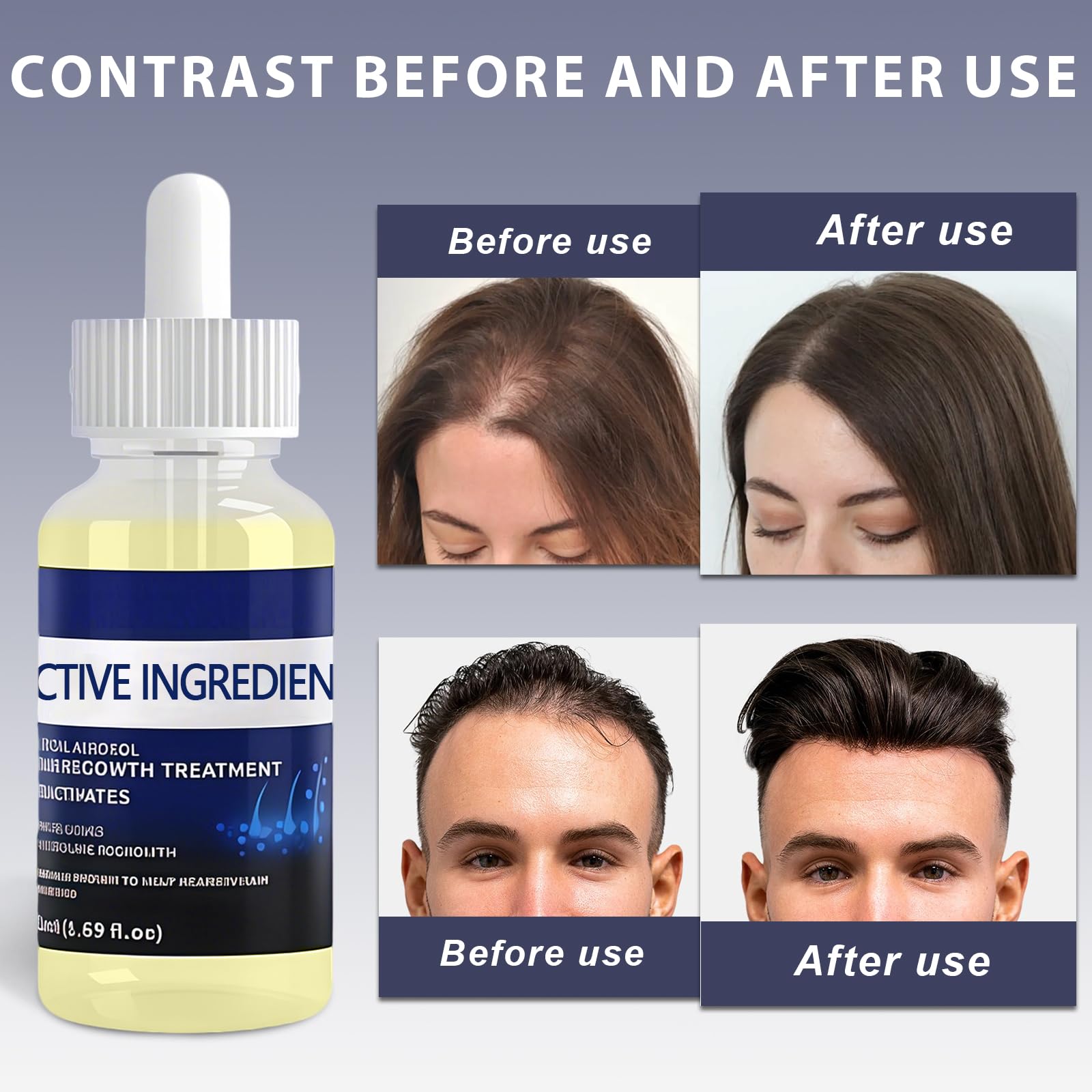 2 Piezas 50ML Serum Anticaida para el Cabello, Nutre el Cuero Cabelludo, Fortalece el Cabello, Nutre el Acelerar Crecimiento del Cabello, Fácil de aplicar para Hombres y Mujeres — view 4