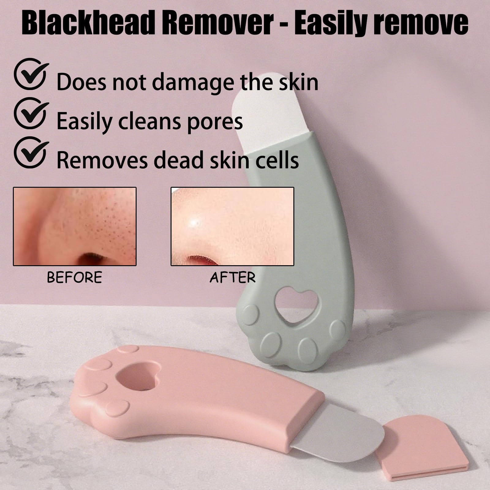 Silicone Facial Pore Scraper, Blackhead Remover Tool, Green and Pink, 2-Pack - Image 2