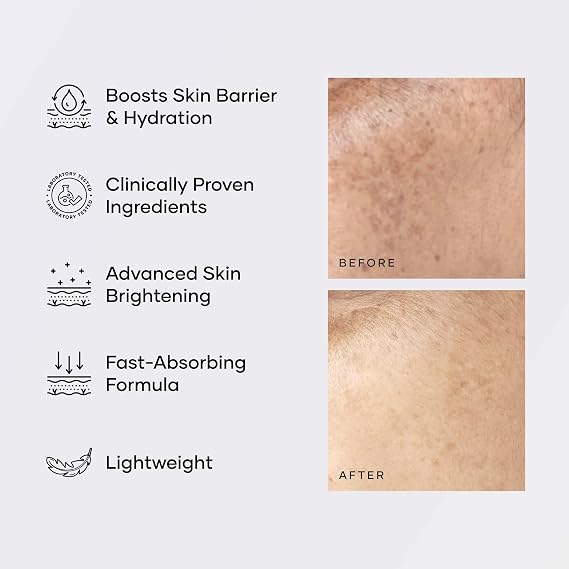 Cureskin Multi-Active Corrector Kojic Acid Face Cream | Kojic Acid, Alpha Arbutin & Niacinamide | For Uneven Skin Tone, Dullness & Visible Spots, 0.53 Ounce (Pack of 1)