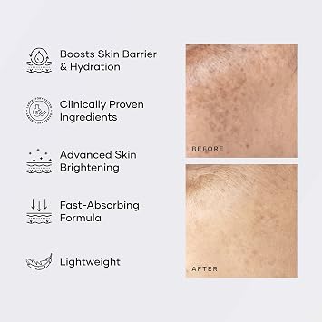 Cureskin Multi-Active Corrector Kojic Acid Face Cream | Kojic Acid, Alpha Arbutin & Niacinamide | For Uneven Skin Tone, Dullness & Visible Spots, 0.53 Ounce (Pack of 1)