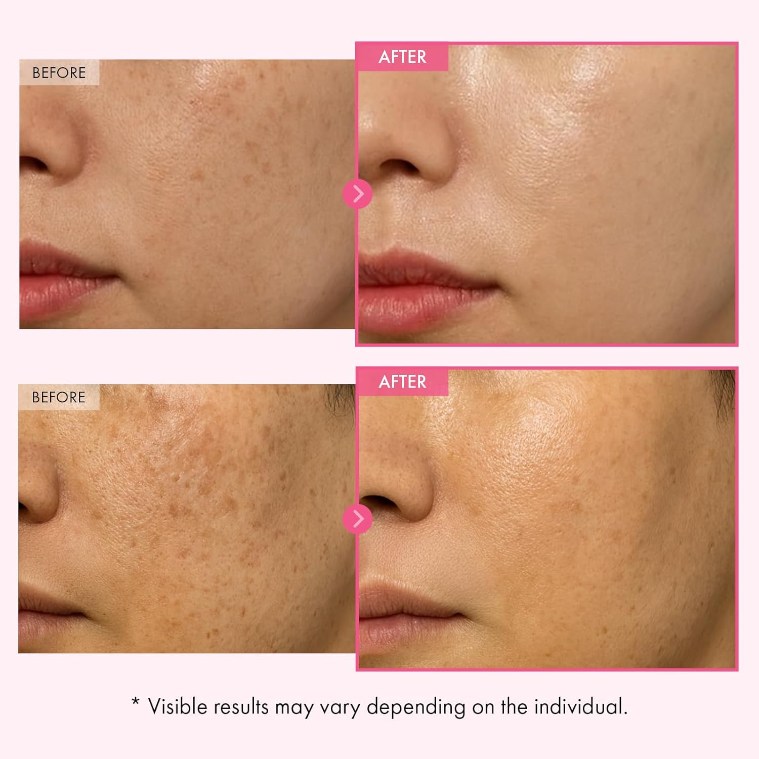 TOSOWOONG Arbutin 7% Glutathione Cream, 70,000ppm Arbutin + 5,001ppm Glutathione, Niacinamide, Dark Spots, Freckle, Blemishes, Pigmentation, Dullness, Uneven Tone, Korean Skin Care, 50ml, 1.69 fl.oz. - Image 3