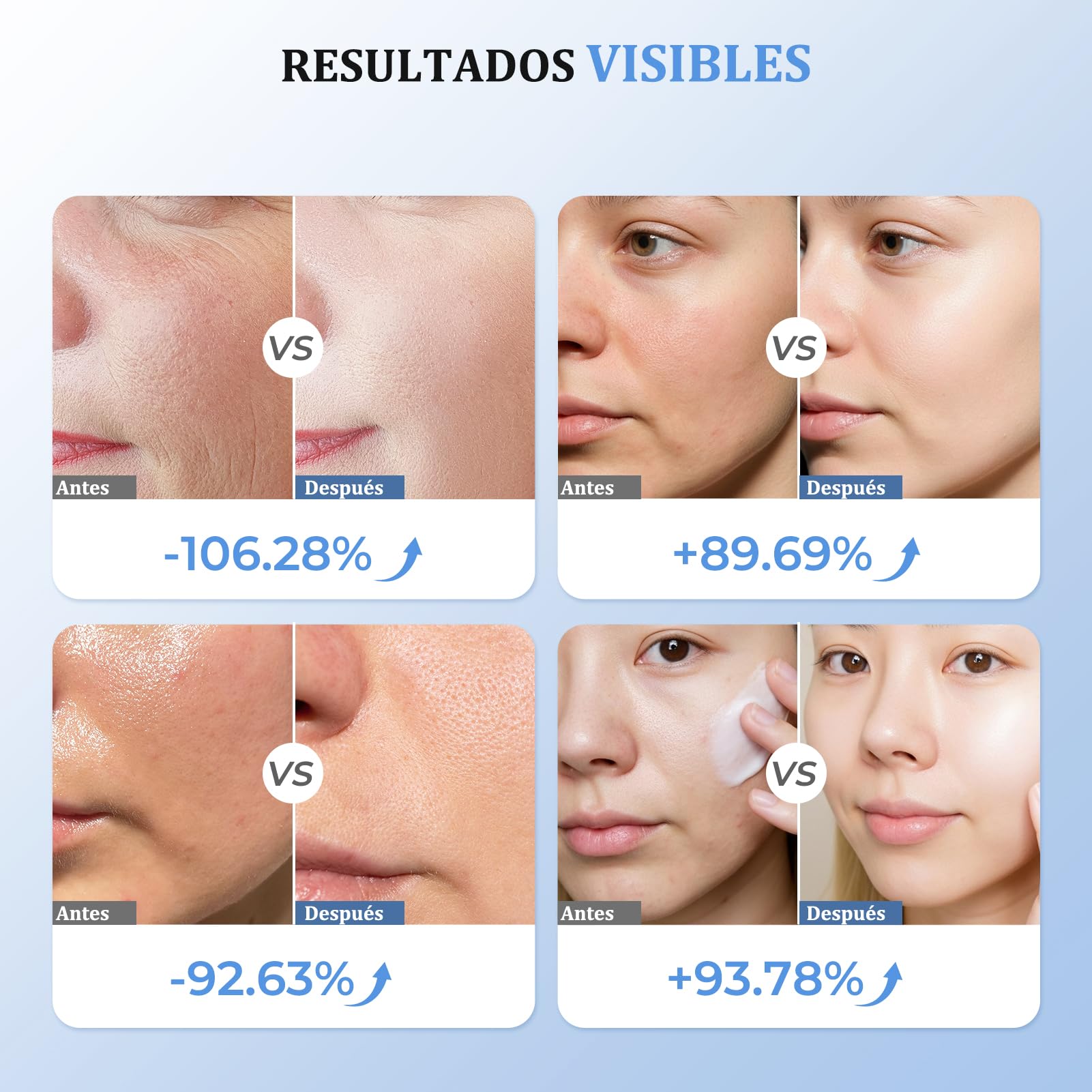 Aparato Radiofrecuencia Facial, 5 en 1 Masajeador Facial de Microcorriente, Dispositivo Eléctrico de Belleza Antiarrugas, Antiacné, Reafirmante y Lifting para Rostro y Cuello