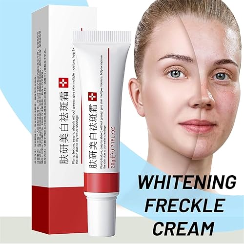 Miniatura 9 de Crema para Manchas Oscuras en La Cara, Cremas para Quitar Manchas de La Cara, Crema Blanqueadora para Pecas, Elimina el Melasma Manchas Oscuras