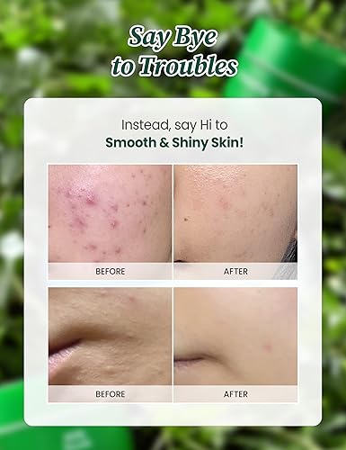 Miniatura 3 de MILKTOUCH Green Apple Pore Minimizer Crema de colágeno para la cara  Crema facial reafirmante minimizadora de poros para la cara  Hidratante facial