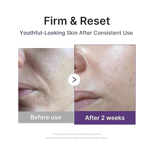 Miniatura 4 de medicube Retinol-some 1.9% Boosting Serum para un cuidado reafirmante intensivo, hidratación y relleno  Piel suave, radiante y de aspecto juvenil