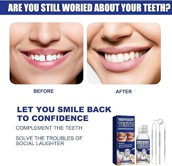 Tooth Filling Repair Kit,Missing Tooth Replacement,Temporary Tooth Replacement Restores Natural Dental Health,Ensures A Firm Bite,Can Be Used at Any Time,Easy to use