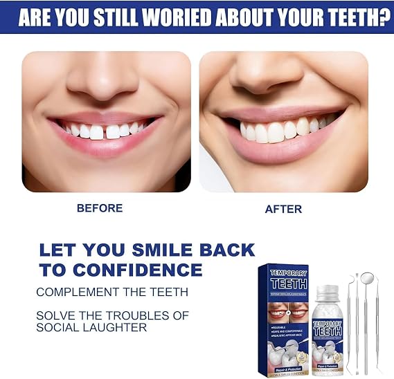 Tooth Filling Repair Kit,Missing Tooth Replacement,Temporary Tooth Replacement Restores Natural Dental Health,Ensures A Firm Bite,Can Be Used at Any Time,Easy to use