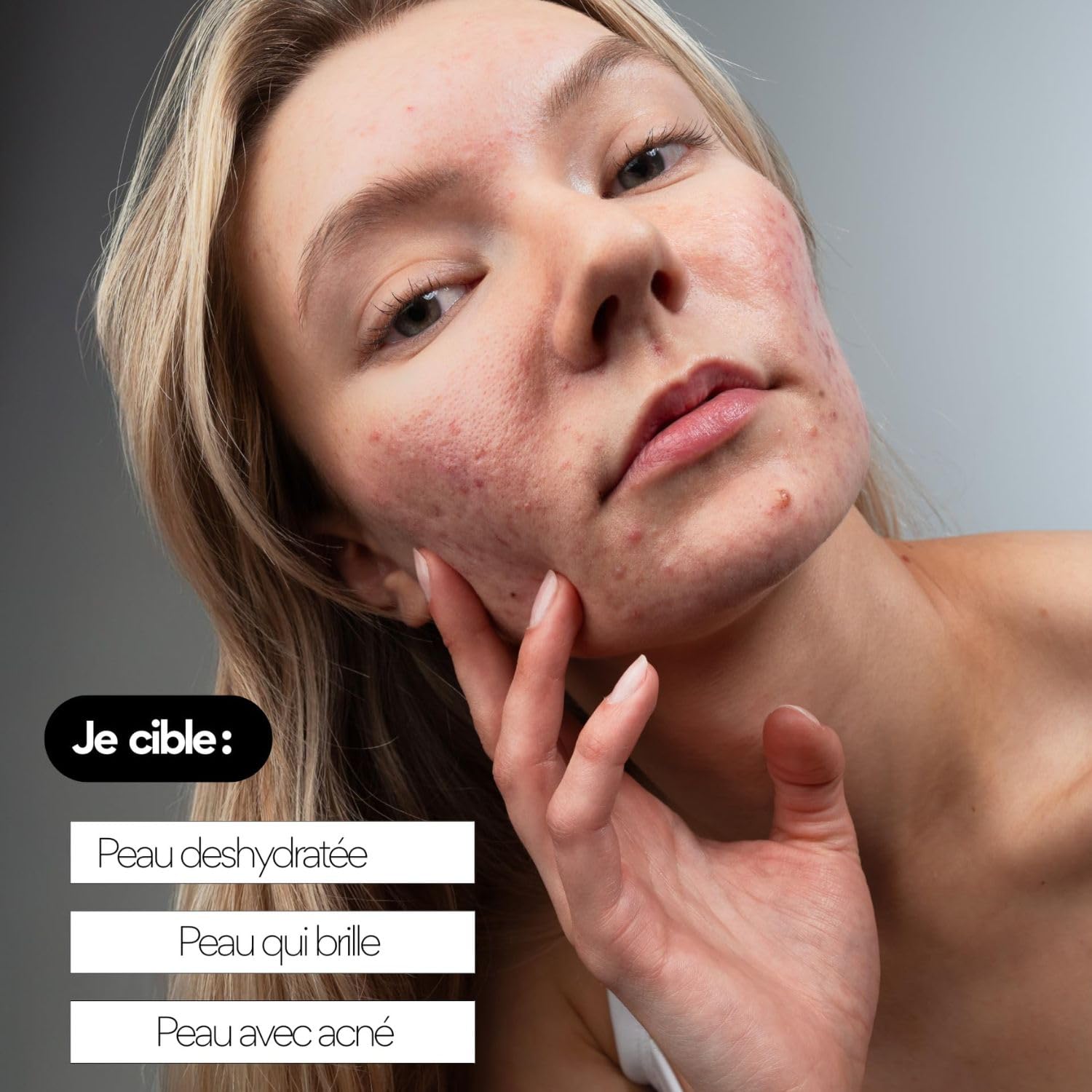 Skin & Out – Crème Hydratante Peaux Mixtes à Grasses – 99% d’Origine Naturelle – Hydrate, Apaise les boutons, Régule le Sébum – Fini non gras
