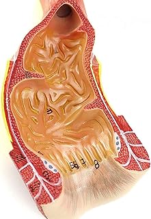 Study Model Educational Model Scientific Human Anatomy Human Rectal Anal Canal Anatomical Model Anorectal Surgery General Surgery Doctor Training Teaching Aids Tool,Medical Models SaiFei