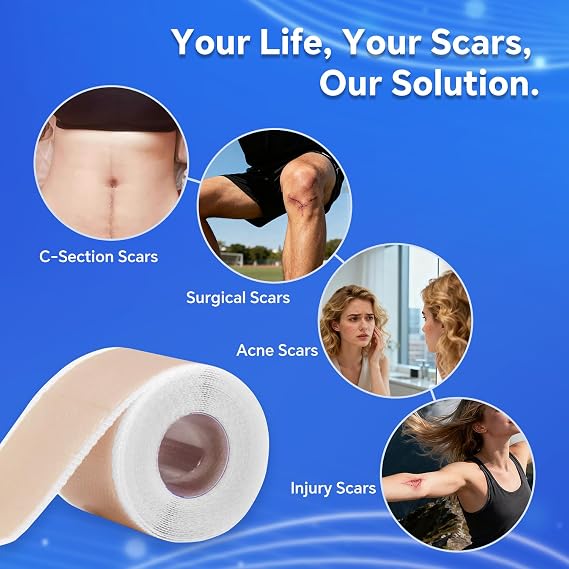 Professional Silicone Scar Sheets, Silicone Scar Tape, Silicone Scar Patch, Reusable Scar Silicone Strips (1.5M)