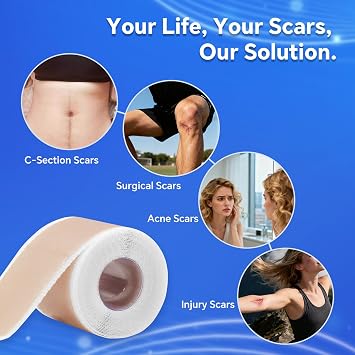 Professional Silicone Scar Sheets, Silicone Scar Tape, Silicone Scar Patch, Reusable Scar Silicone Strips (1.5M)
