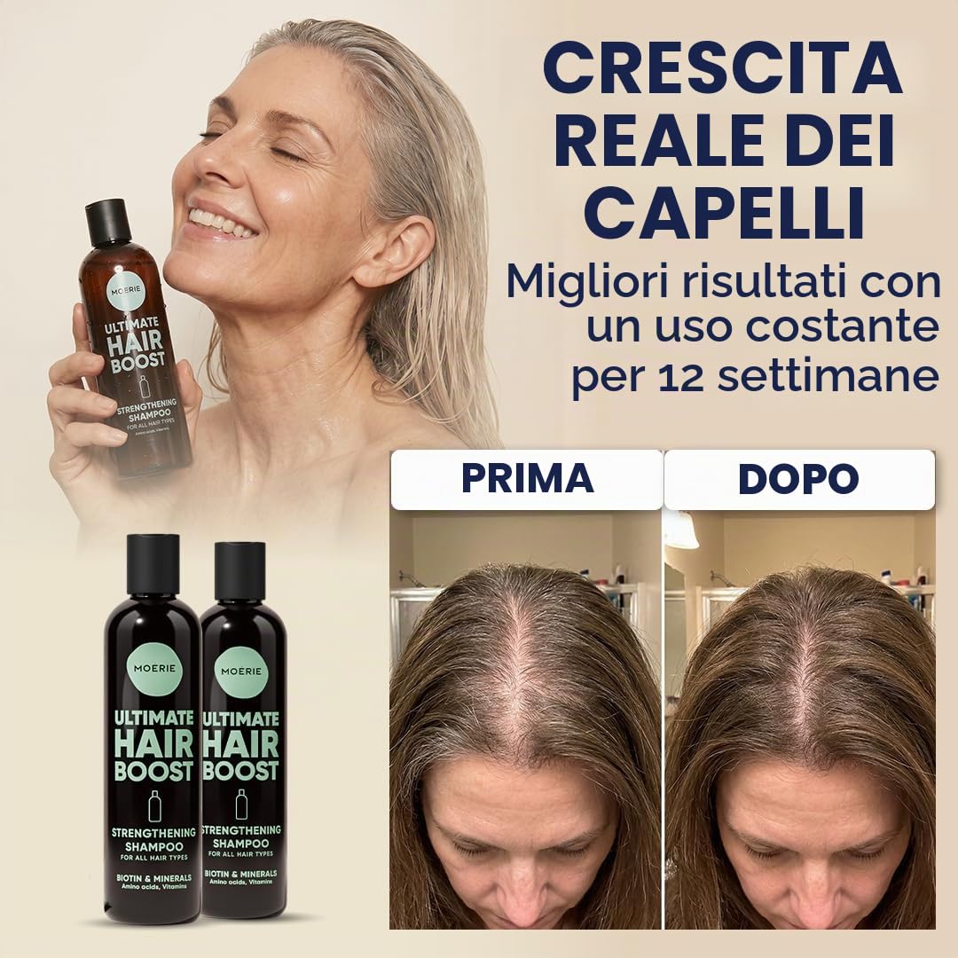 Moérie shampoo crescita capello premium per lunghi e folti, volumizzante vegan-friendly senza parabeni o silicone per tutti, shampoo anticadulla uomo e donna (250 ml) x2