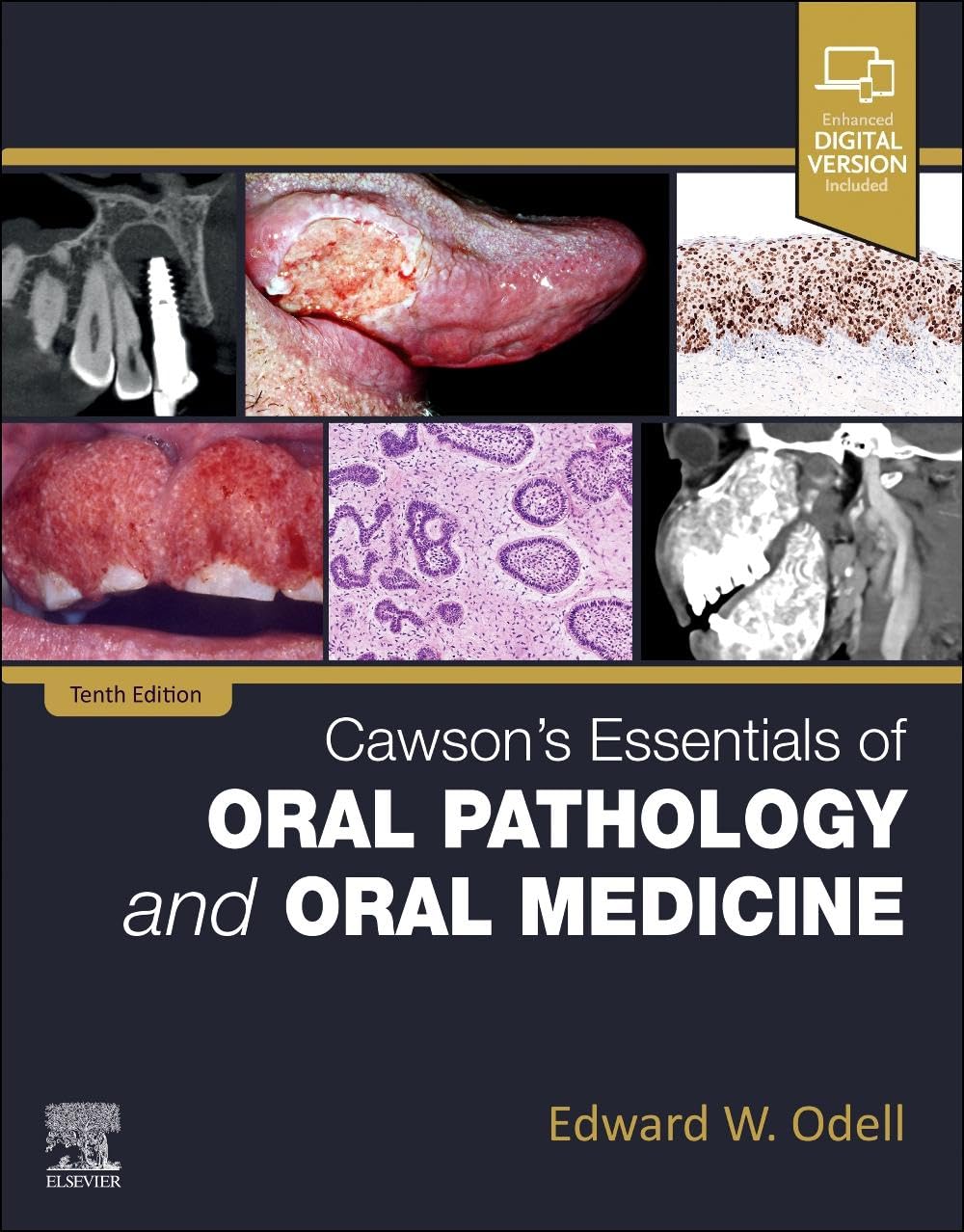 Cawson's Essentials of Oral Pathology and Oral Medicine Paperback – Big Book, 27 April 2024