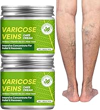 Varicose Veins Care Cream for Legs – Fast-Acting for Blood Circulation & Relieves Heaviness and Tension – Soothing Varicose Veins Cream with Natural Herbal Extracts, 60g*2