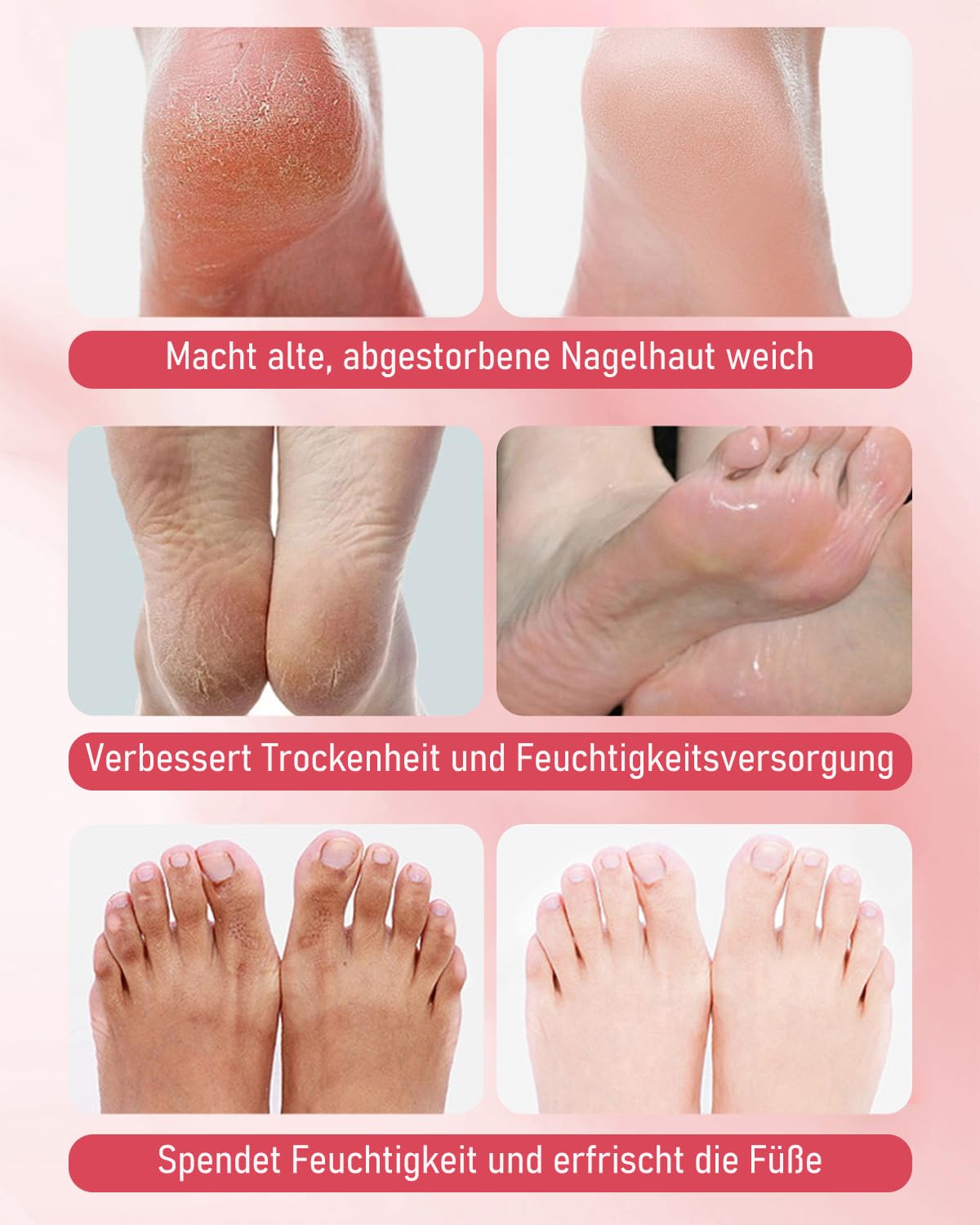 6 paia di maschere per piedi di pesca con niacinamide, idratanti e riparanti, peeling contro calli e pelle secca, maschera per piedi morbidi e delicati