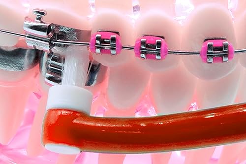 Miniatura 8 de edel+white Paquete de 2 cepillos de dientes End Tuft – Cepillo de cabeza pequeña para aparatos ortopédicos, implantes y encías – Cepillo especial