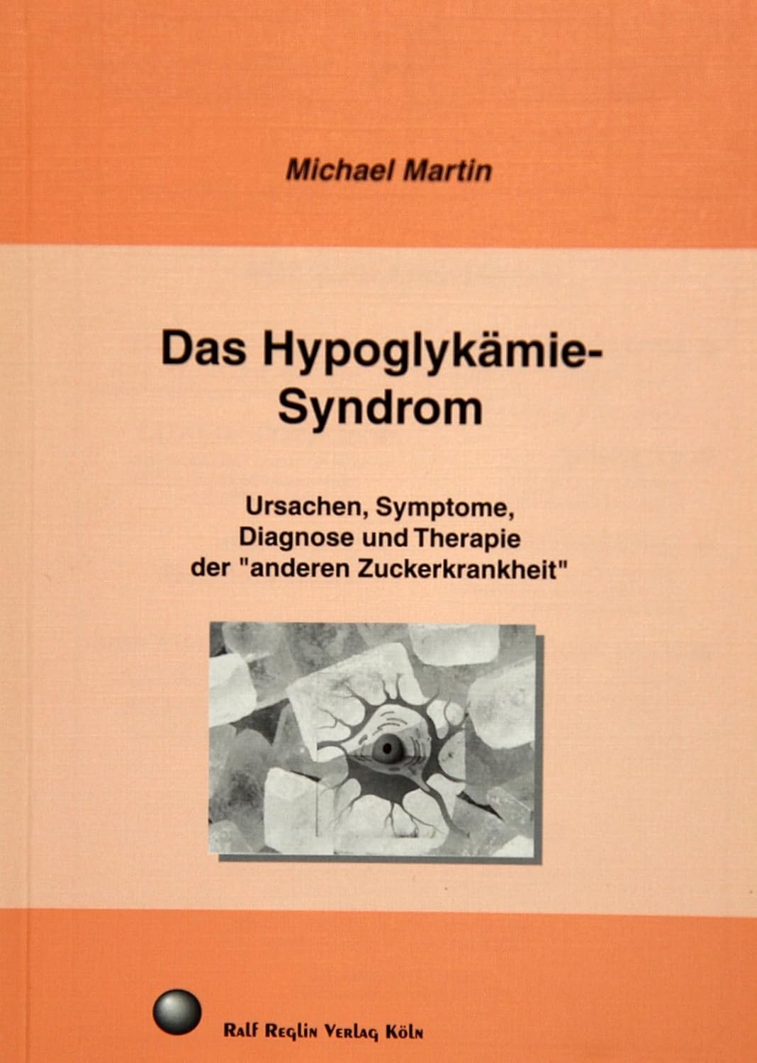 Das HypoglykämieSyndrom. Ursachen, Symptome, Diagnostik und Therapie