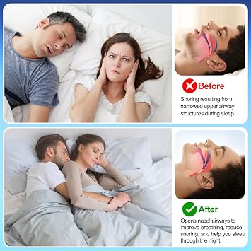 Nasal Strips, Snoring Aids for Men and Women, 50 Pieces Nose Strips Anti Snoring Devices, Help Improve Breathing, Reduce Snoring, Relieve Nasal Congestion, Drug-Free, Deeper Sleep.