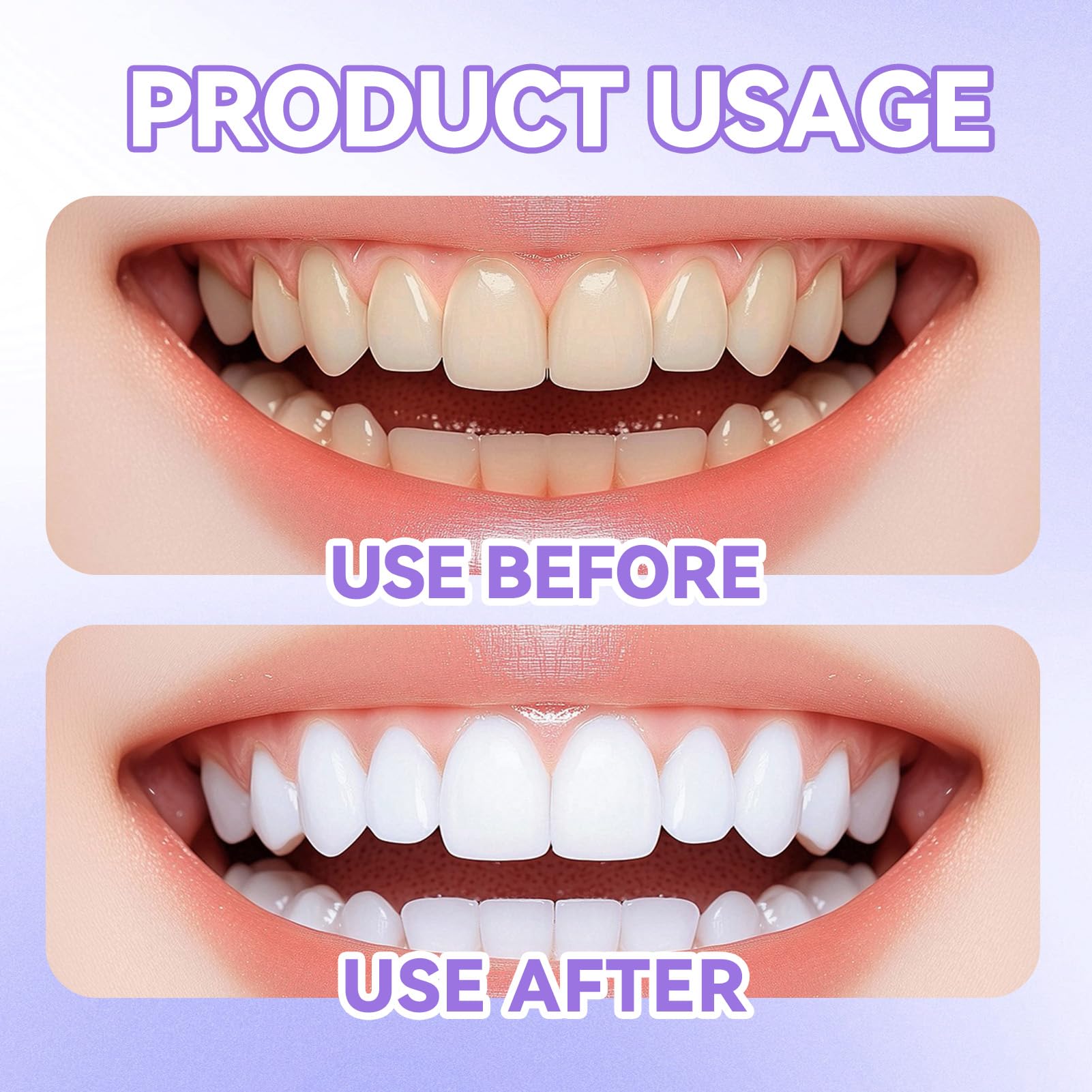 Papel de lija dental 4mm x 6m para espacios interdentales y pulido