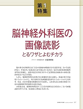 脳神経外科速報 2019年3月号(第29巻3号)特集:脳神経外科術中モニタリング 脳神経外科速報 2024年4号〈特集〉脳神経外科医の画像読影（第34