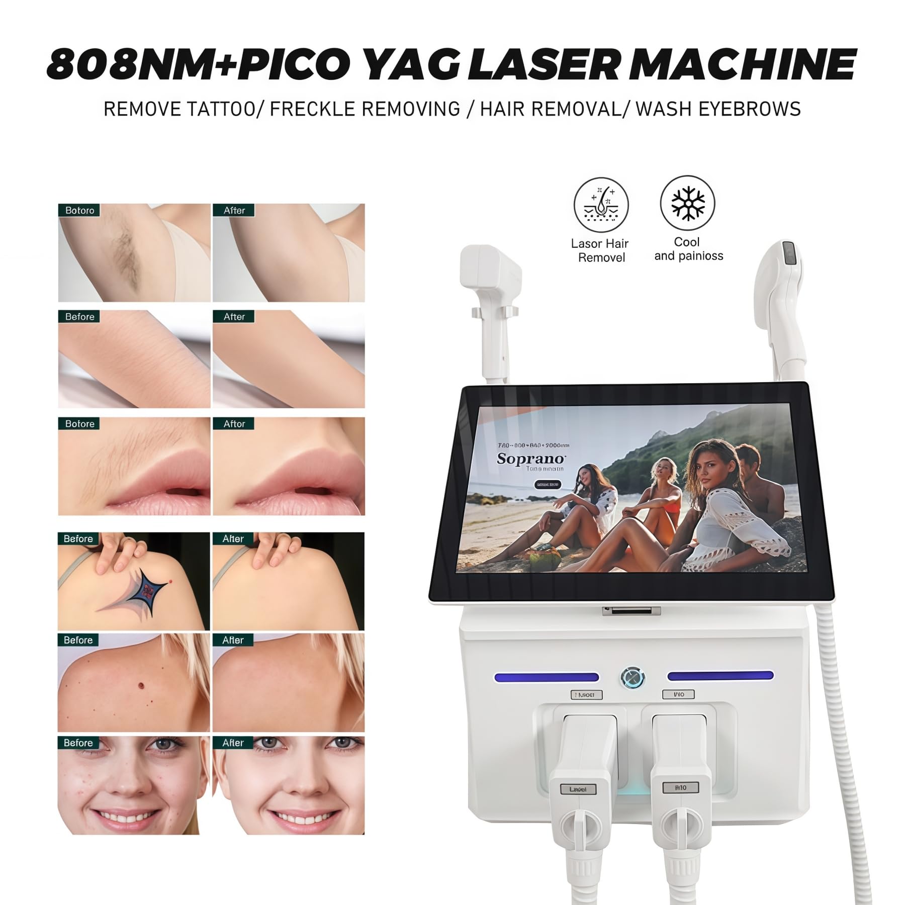 Laser diodo 2 in 1 808nm + macchina laser picosecondi per depilazione professionale, 4 lunghezza d'onda 755nm 808nm 940nm 1064nm, bellezza della pelle, rimozione del tatuaggio/pigmento