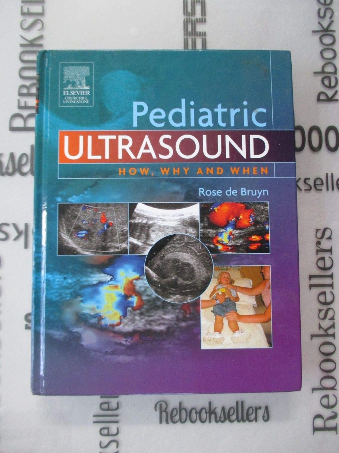 Pediatric Ultrasound How, Why And When de Bruyn MBBCh DMRD FRCR