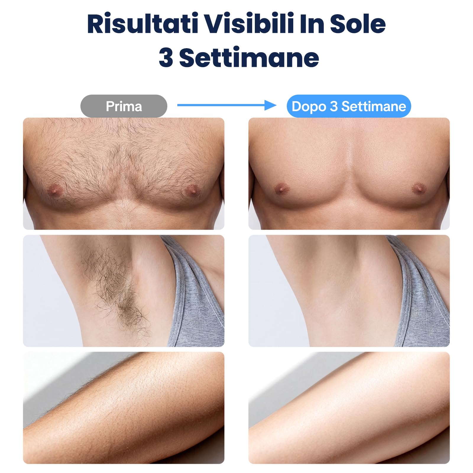 MANKIW Dispositivo IPL Epilazione con Funzione Raffreddante, 5 Livelli di Energia & 500.000 Impulsi Luminosi, Modalità Automatica e Manuale, Alternativa alla Depilazione Laser, Gambe, Ascelle e Bikini
