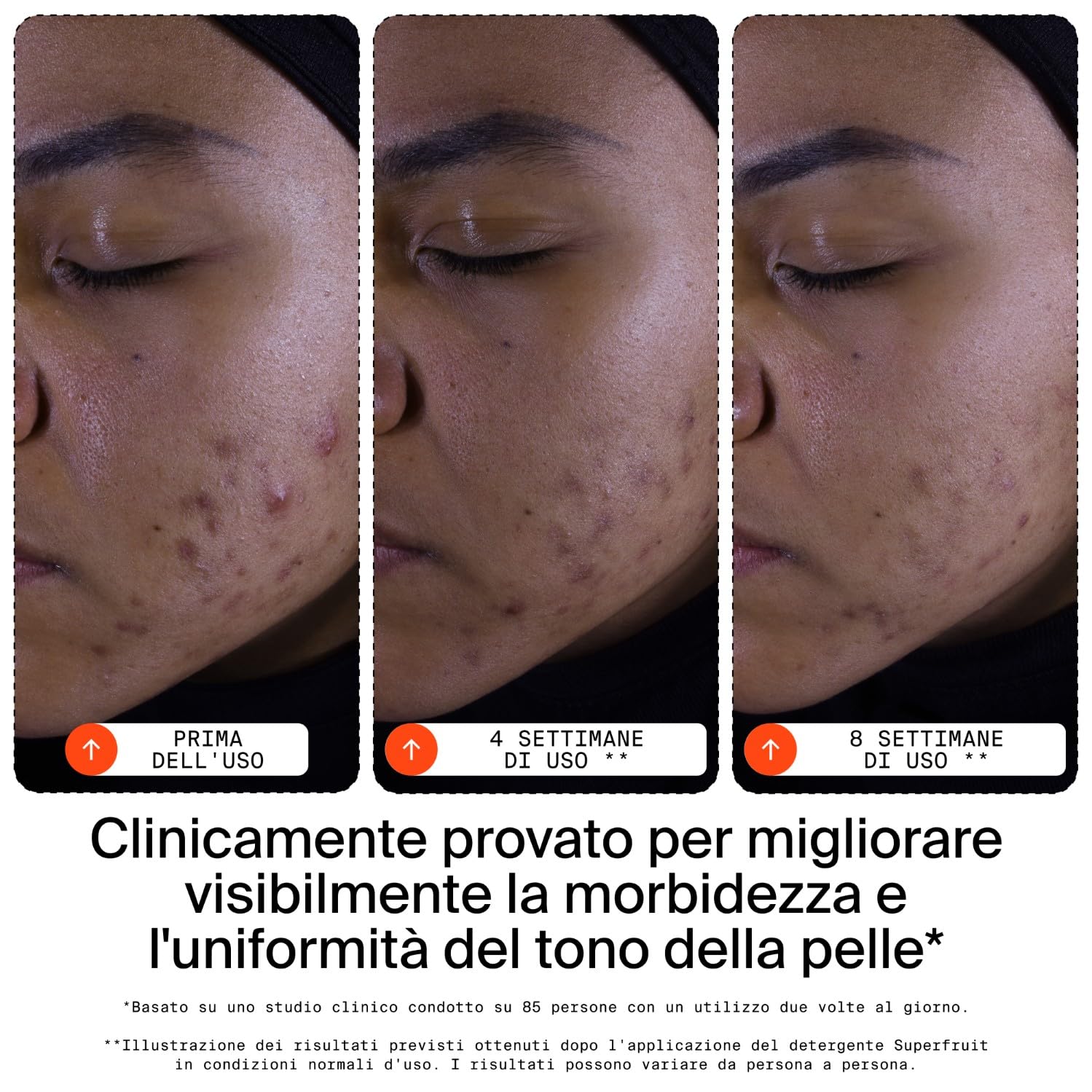 Youth To The People Superfruit Cleanser, Detergente Viso Esfoliante Delicato, Con Papaya e Vitamina C, Detergente Idratante Lenitivo, Illuminante, Struccante Delicato per la Pelle