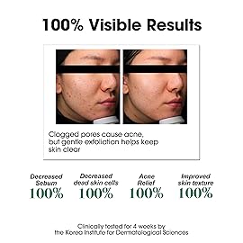 SOME BY MI AHA BHA PHA 30 Days Miracle Toner - Pack of 2 - Korean Salicylic Acid Exfoliating Face Toner for All Skin Types - Daily Pore Care & Oil Control with 2% Niacinamide - Korean Skin Care