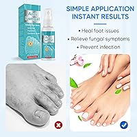 Vista 7 de Athletes-Foot-Spray Atletes-Tratamiento de Pies-Aerosol Atletas-Tratamiento de Pies-Para-Pie-Suavida-Ingredientes Naturales 1.7fl oz 1.6fl.oz.