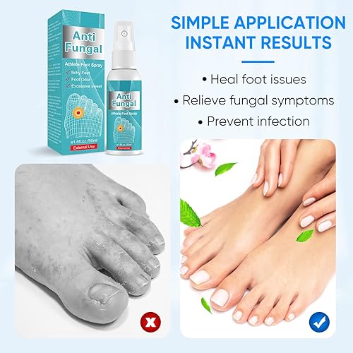 Miniatura 7 de Athletes-Foot-Spray Atletes-Tratamiento de Pies-Aerosol Atletas-Tratamiento de Pies-Para-Pie-Suavida-Ingredientes Naturales 1.7fl oz 1.6fl.oz.