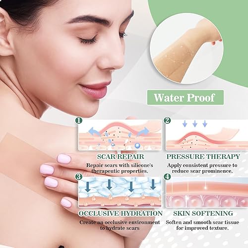 Miniatura 5 de Softxpp - Hojas de silicona de grado médico para cicatrices, cinta reutilizable para cicatrices de 1.6 x 60 pulgadas, rollo de 4.9 ft, tiras de