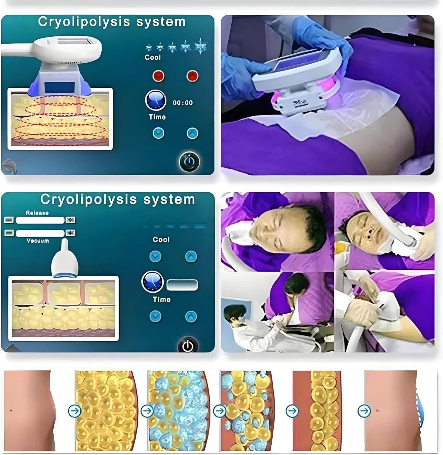 Appareil de cryolipolyse pour l'élimination des Graisses par Le Froid, avec 3 poignées, Appareil de beauté et d'amincissement.