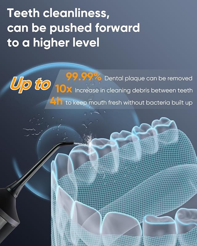 MySmile LP221 Vezeték Nélküli Szájzuhany OLED Kijelzővel - 335ml Víztartály, 4 Üzemmód, 8 Fej, UV Sterilizálás, Utazótáska, Fogköztisztító