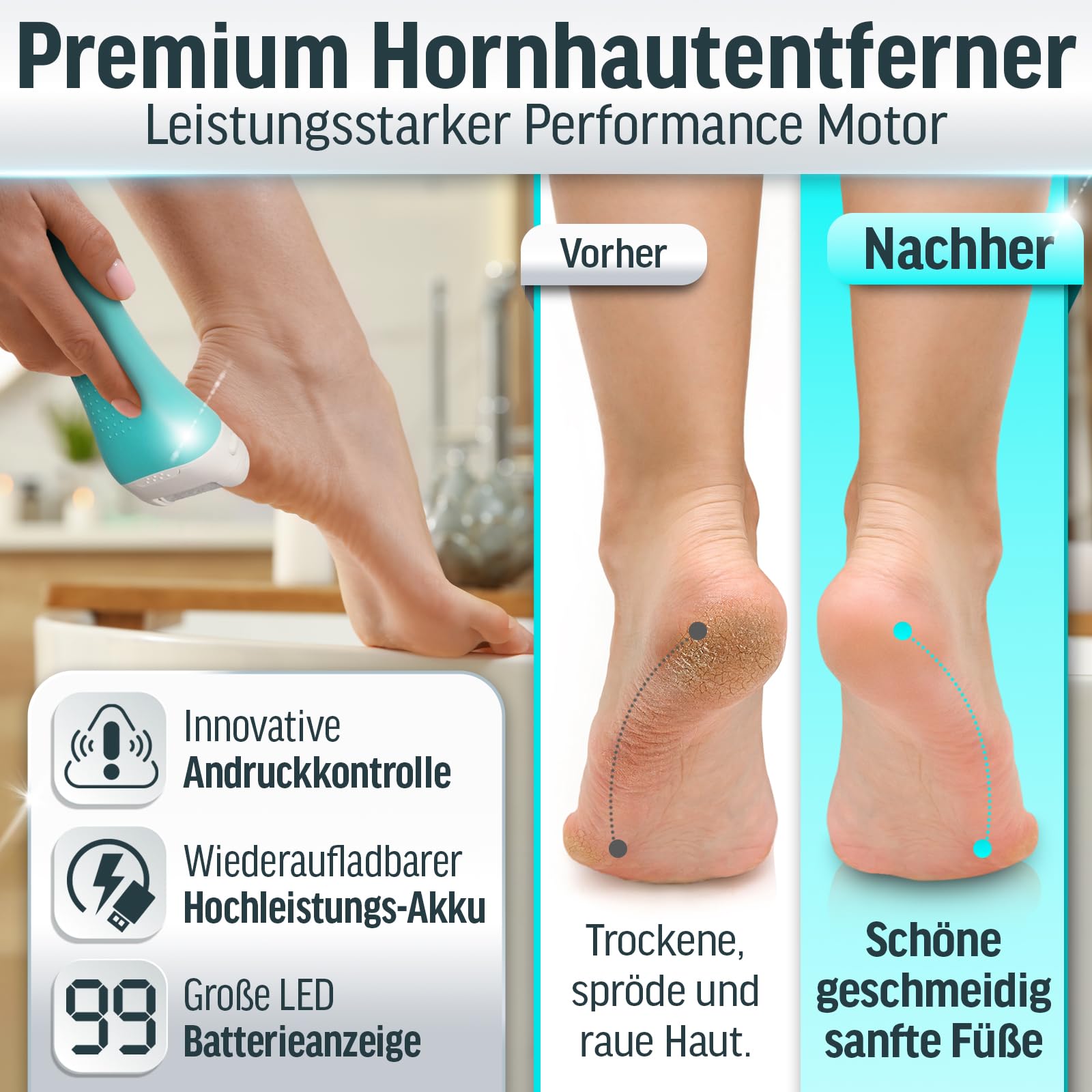 Grundig Hornhautentferner elektrisch Pro - schnell Hornhaut entfernen ohne Bücken - Premium Akku Hornhaut Entferner nass + trocken mit Arbeitslicht, 3 Fuß Rollen, wiederaufladbar