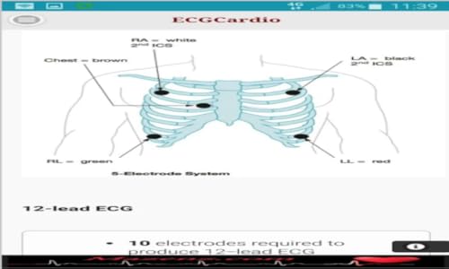 ECGCardio