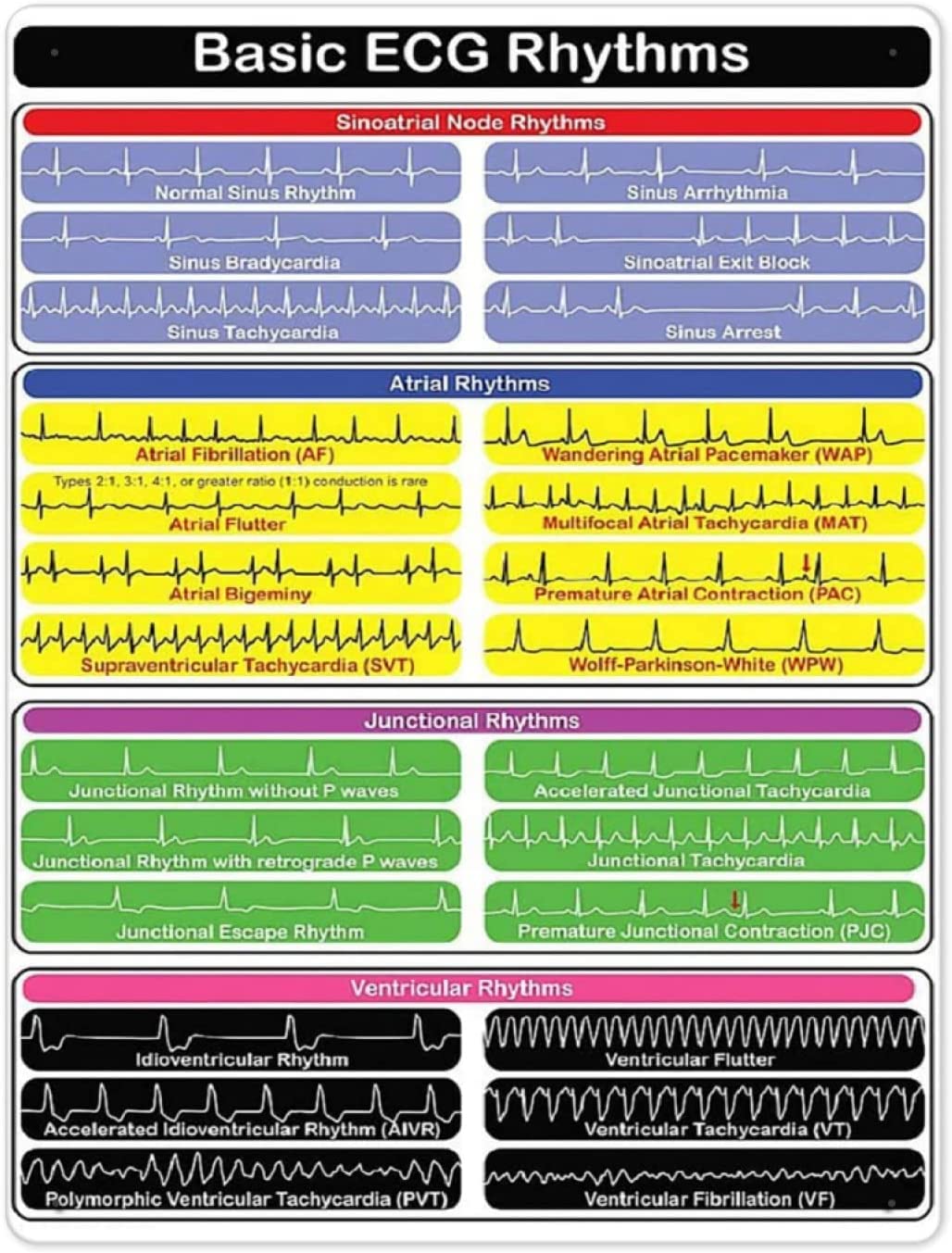 Wall Sign Basic Ecg Rhythms Chart Cardiology Knowledge Wall Poster Aluminium Metal Tin Signs Novelty Wall Decor For Pub, Bathroom, Restaurant 30x40cm