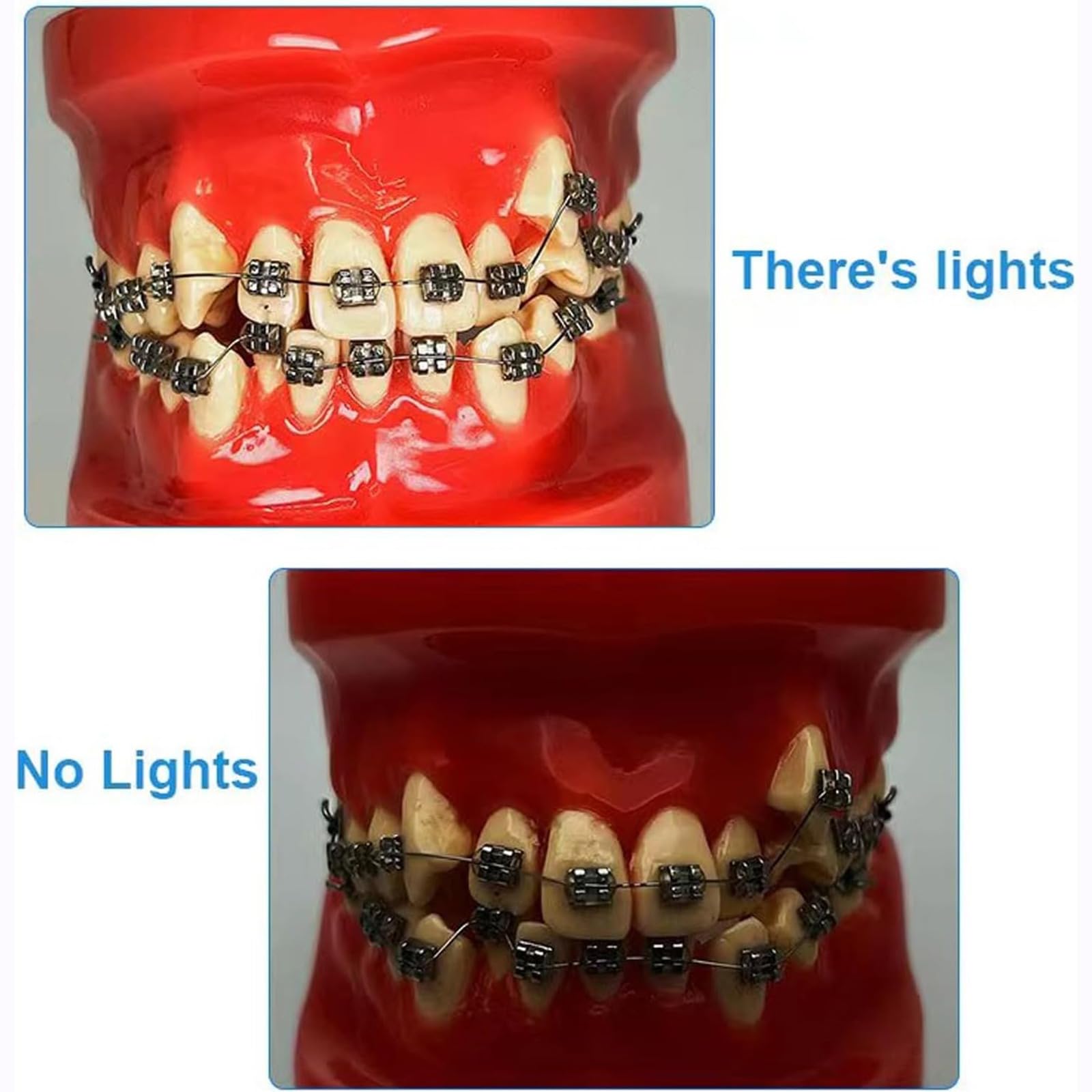 LED Dental Blitzlicht für Professionelle Fotografie, Oralkamera Fülllicht Hilfe für Zahnkliniken, Ideal für Foto- und Videoanwendungen